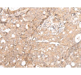 FOXO4 Antibody from Signalway Antibody (43669) - Antibodies.com