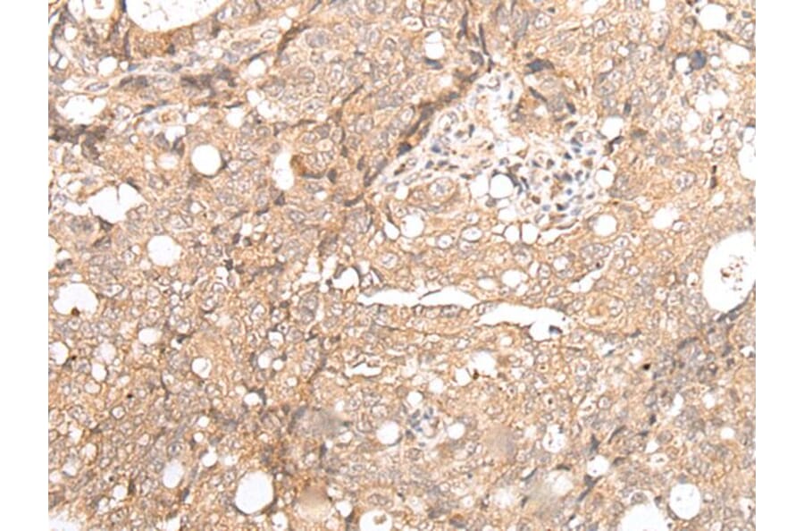 FOXO4 Antibody from Signalway Antibody (43669) - Antibodies.com