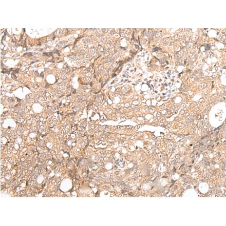 FOXO4 Antibody from Signalway Antibody (43669) - Antibodies.com