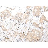 FOXO4 Antibody from Signalway Antibody (43669) - Antibodies.com