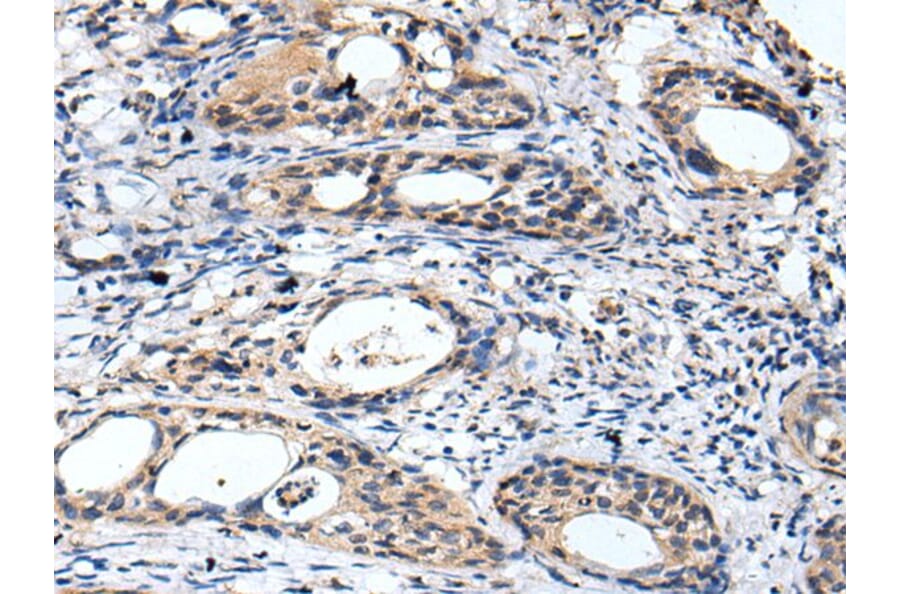 GTSE1 Antibody from Signalway Antibody (43680) - Antibodies.com