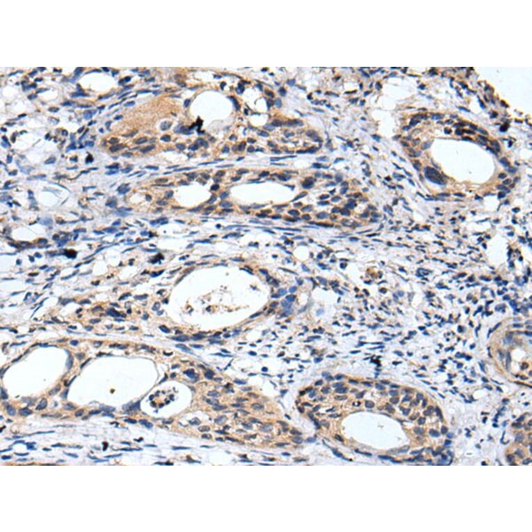 GTSE1 Antibody from Signalway Antibody (43680) - Antibodies.com