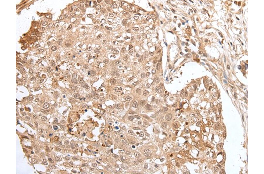 HOXA3 Antibody from Signalway Antibody (43684) - Antibodies.com