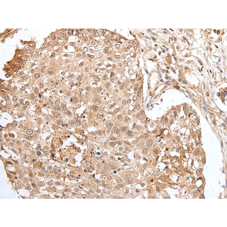 HOXA3 Antibody from Signalway Antibody (43684) - Antibodies.com