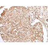 HOXA3 Antibody from Signalway Antibody (43684) - Antibodies.com