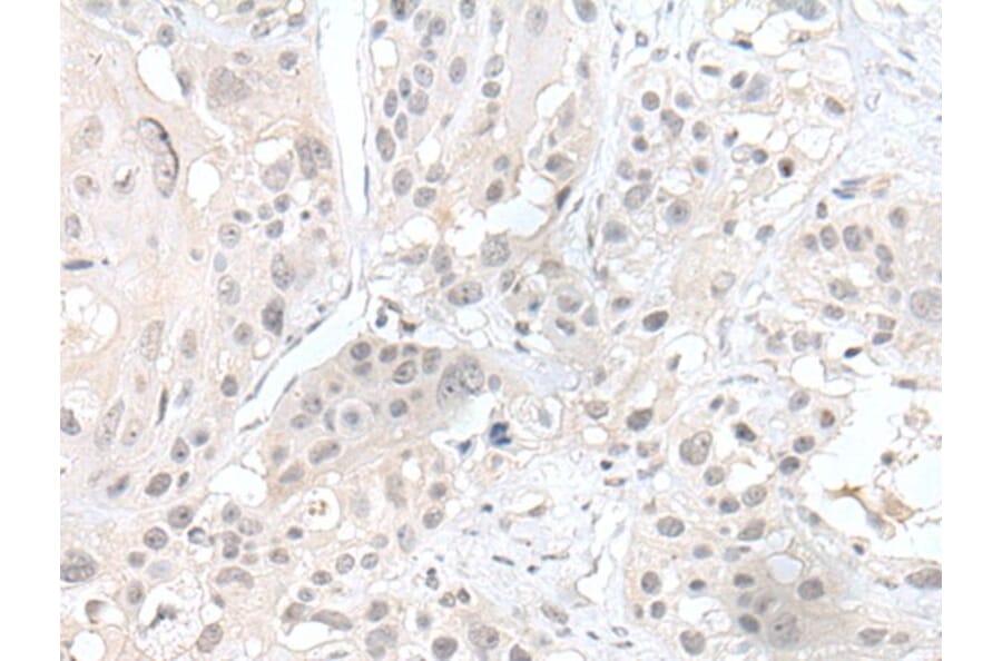 HDAC4 Antibody from Signalway Antibody (43687) - Antibodies.com