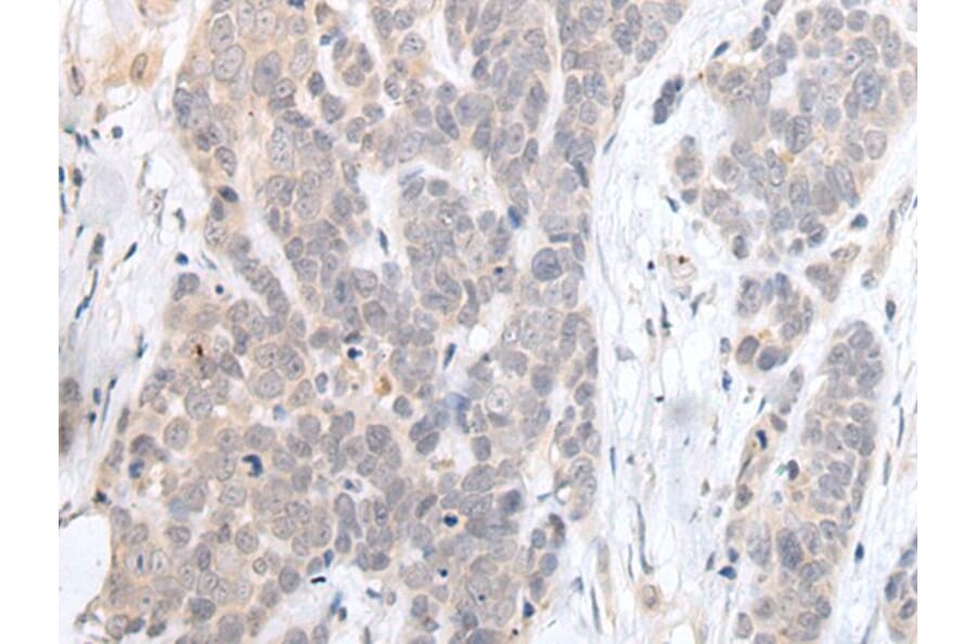 HDAC4 Antibody from Signalway Antibody (43687) - Antibodies.com