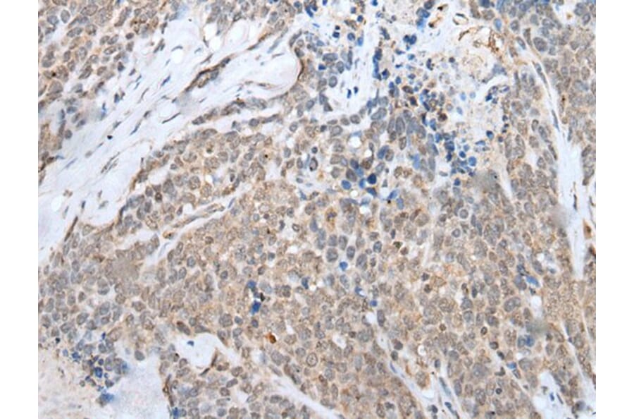 HOXB7 Antibody from Signalway Antibody (43688) - Antibodies.com