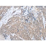 HOXB7 Antibody from Signalway Antibody (43688) - Antibodies.com