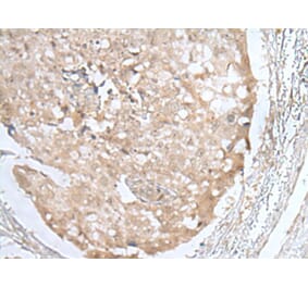 HOXD3 Antibody from Signalway Antibody (43689) - Antibodies.com