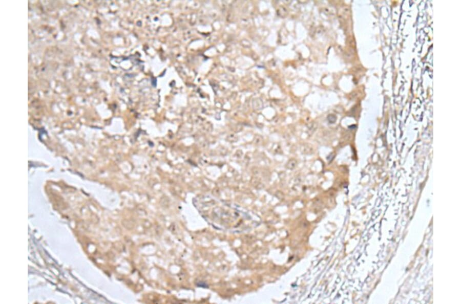 HOXD3 Antibody from Signalway Antibody (43689) - Antibodies.com