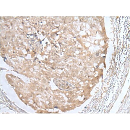 HOXD3 Antibody from Signalway Antibody (43689) - Antibodies.com