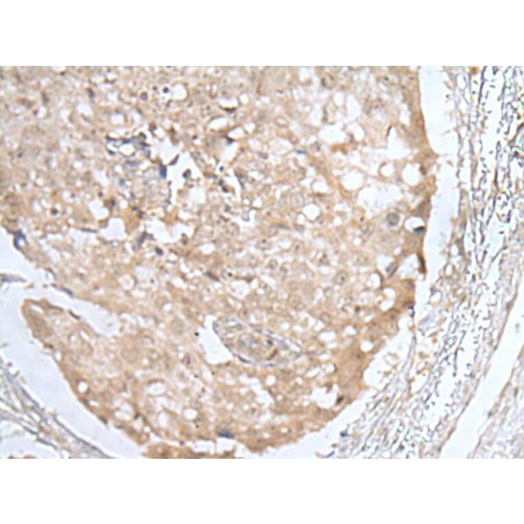 HOXD3 Antibody from Signalway Antibody (43689) - Antibodies.com