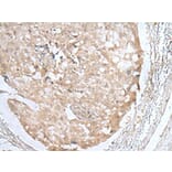 HOXD3 Antibody from Signalway Antibody (43689) - Antibodies.com