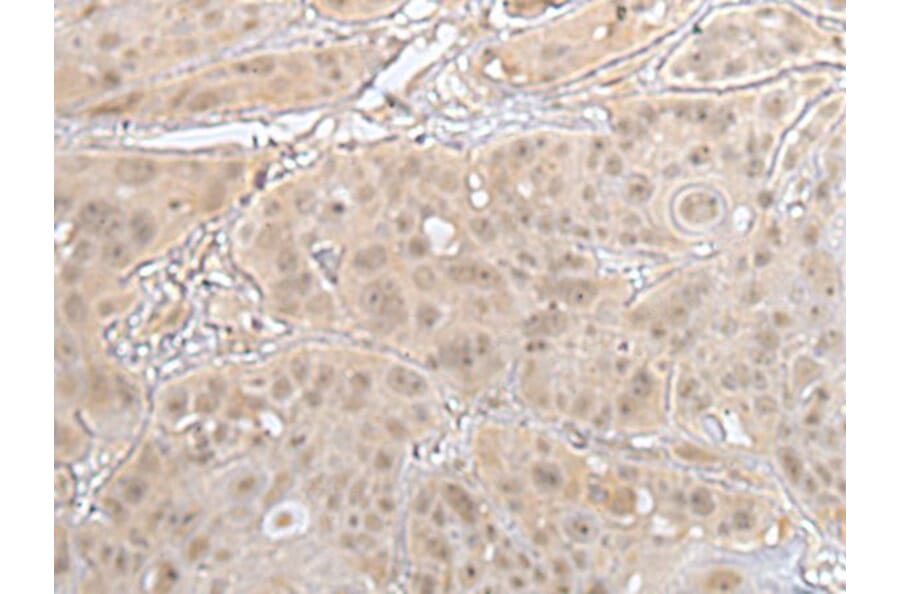 HOXD3 Antibody from Signalway Antibody (43689) - Antibodies.com