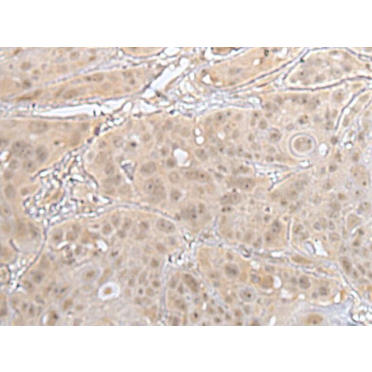 HOXD3 Antibody from Signalway Antibody (43689) - Antibodies.com