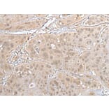 HOXD3 Antibody from Signalway Antibody (43689) - Antibodies.com