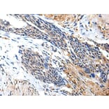 PTPRG Antibody from Signalway Antibody (43700) - Antibodies.com