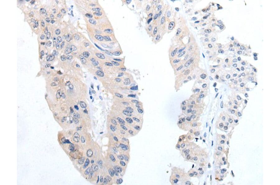 TGFB3 Antibody from Signalway Antibody (43702) - Antibodies.com