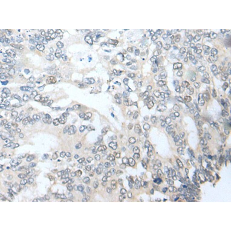 TGFB3 Antibody from Signalway Antibody (43702) - Antibodies.com