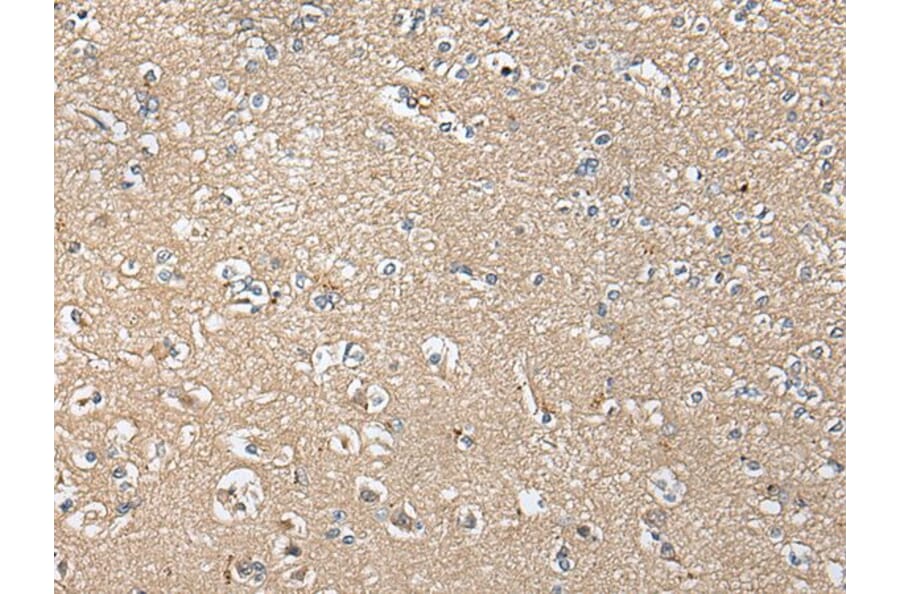 KLHL4 Antibody from Signalway Antibody (43707) - Antibodies.com