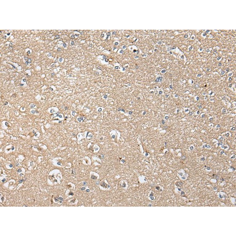 KLHL4 Antibody from Signalway Antibody (43707) - Antibodies.com