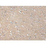 KLHL4 Antibody from Signalway Antibody (43707) - Antibodies.com