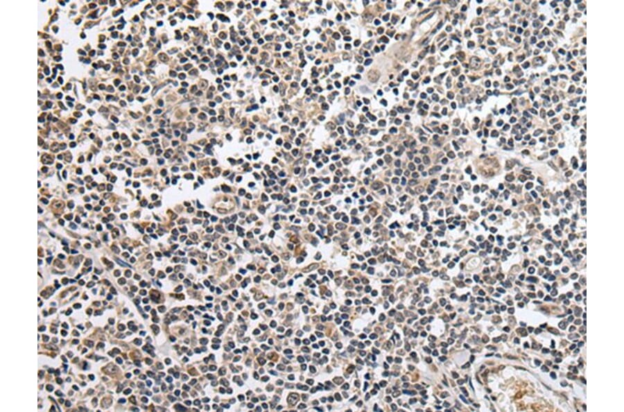KLHL4 Antibody from Signalway Antibody (43707) - Antibodies.com