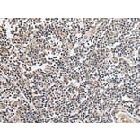 KLHL4 Antibody from Signalway Antibody (43707) - Antibodies.com