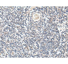 PROK1 Antibody from Signalway Antibody (43709) - Antibodies.com