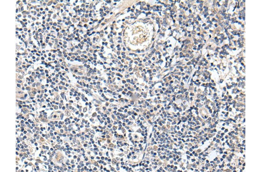 PROK1 Antibody from Signalway Antibody (43709) - Antibodies.com