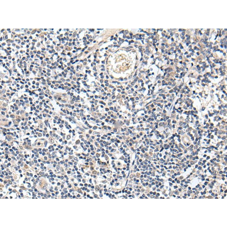 PROK1 Antibody from Signalway Antibody (43709) - Antibodies.com