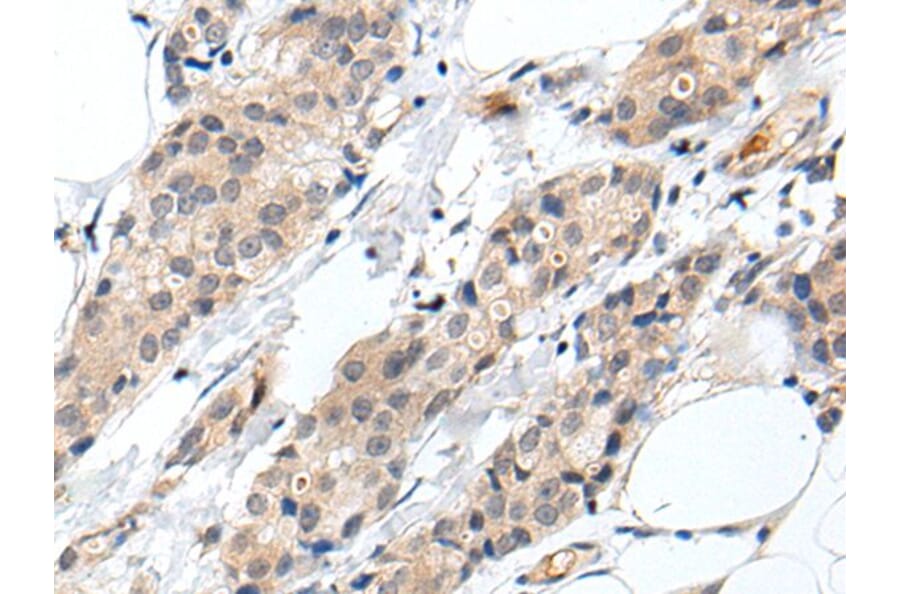 PROK1 Antibody from Signalway Antibody (43709) - Antibodies.com