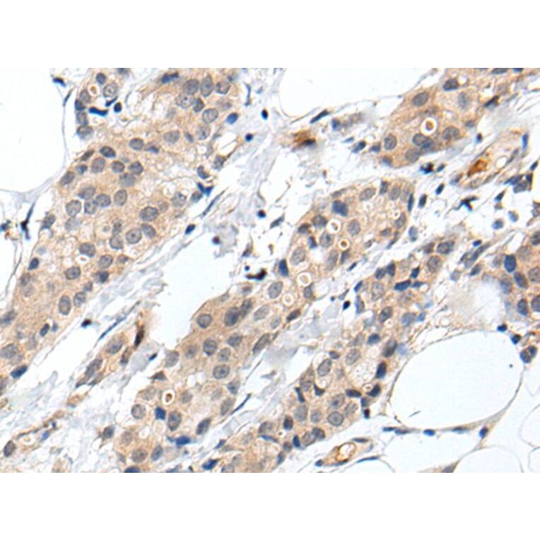 PROK1 Antibody from Signalway Antibody (43709) - Antibodies.com