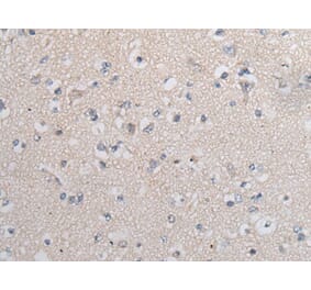 TGFB1 Antibody from Signalway Antibody (43711) - Antibodies.com