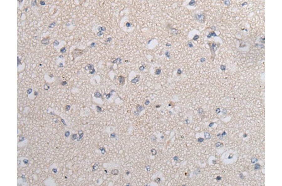 TGFB1 Antibody from Signalway Antibody (43711) - Antibodies.com