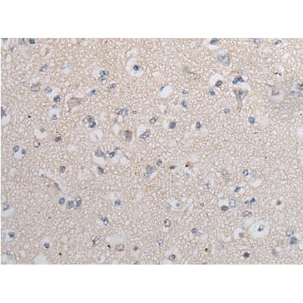 TGFB1 Antibody from Signalway Antibody (43711) - Antibodies.com