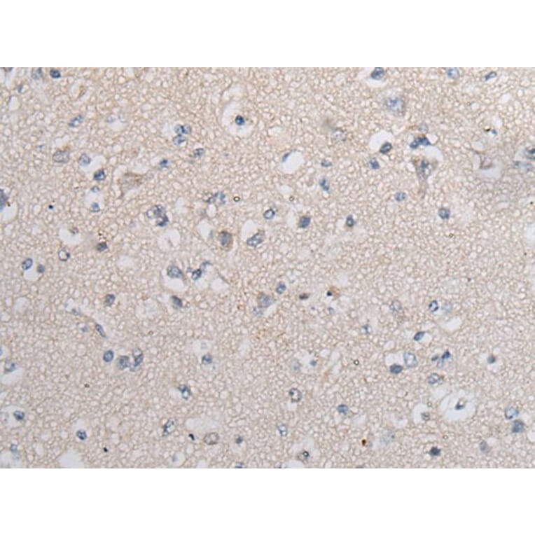 TGFB1 Antibody from Signalway Antibody (43711) - Antibodies.com