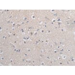 TGFB1 Antibody from Signalway Antibody (43711) - Antibodies.com