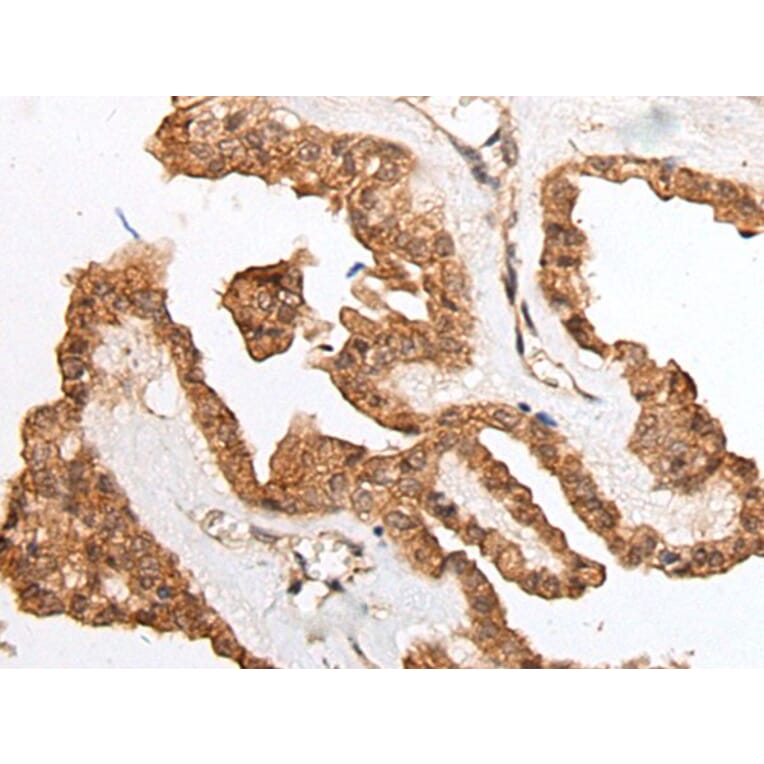 HOXB9 Antibody from Signalway Antibody (43713) - Antibodies.com