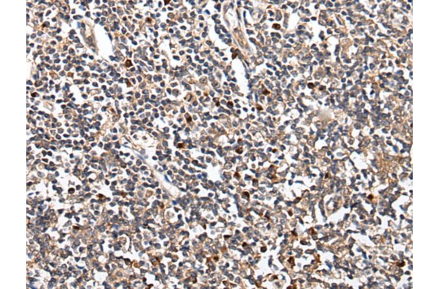 HOXB9 Antibody from Signalway Antibody (43713) - Antibodies.com