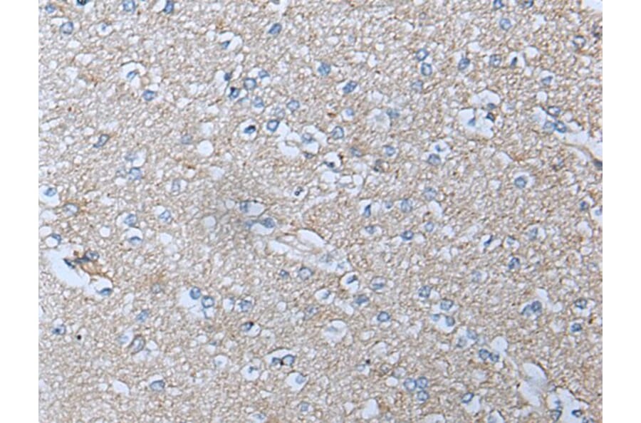 ACKR3 Antibody from Signalway Antibody (43714) - Antibodies.com