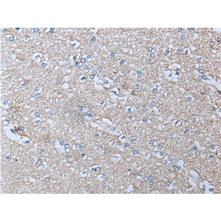 ACKR3 Antibody from Signalway Antibody (43714) - Antibodies.com