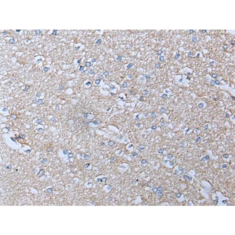 ACKR3 Antibody from Signalway Antibody (43714) - Antibodies.com