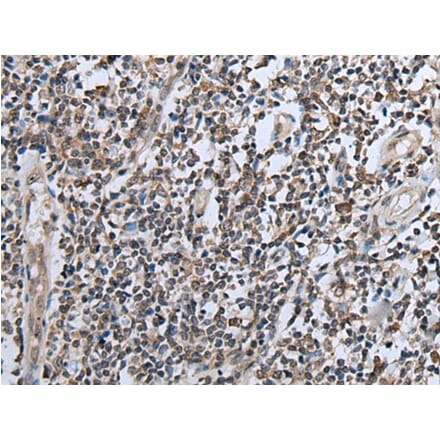 CXCL6 Antibody from Signalway Antibody (43727) - Antibodies.com
