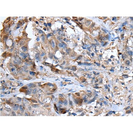 CXCL5 Antibody from Signalway Antibody (43728) - Antibodies.com