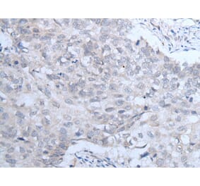 IGF1R Antibody from Signalway Antibody (43735) - Antibodies.com