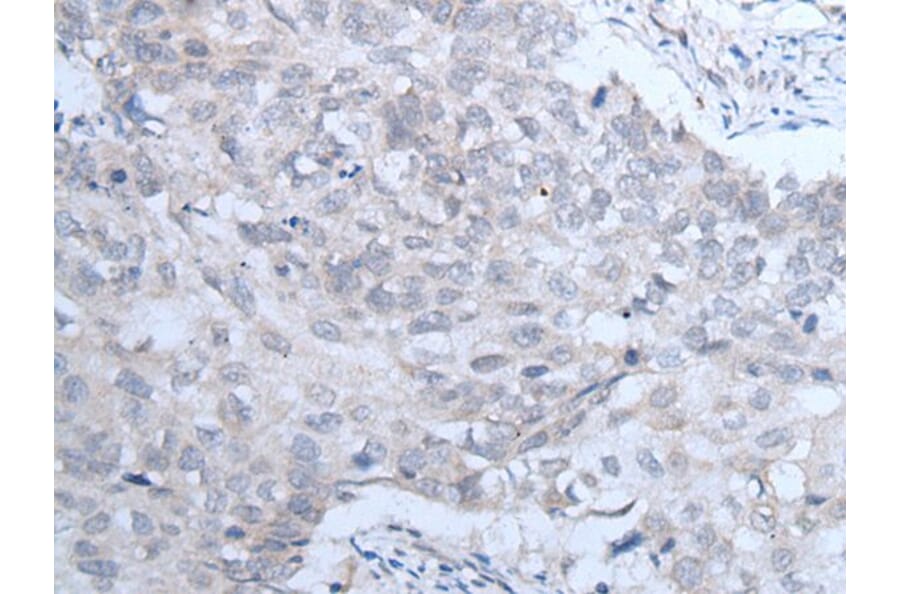 IGF1R Antibody from Signalway Antibody (43735) - Antibodies.com