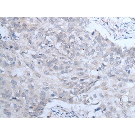 IGF1R Antibody from Signalway Antibody (43735) - Antibodies.com