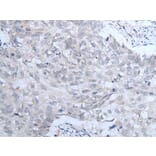 IGF1R Antibody from Signalway Antibody (43735) - Antibodies.com